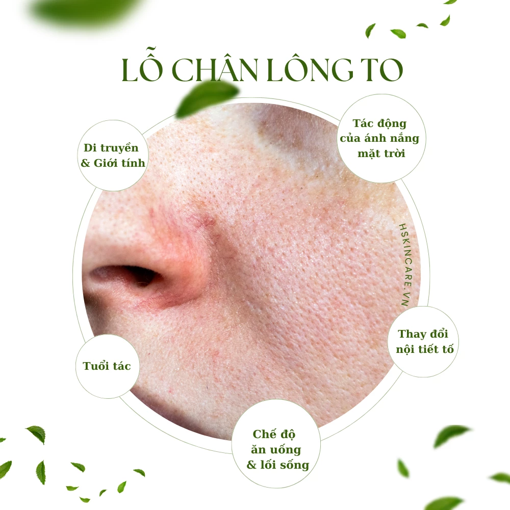 cach-tri-lo-chan-long-to-cho-da-nhon-1